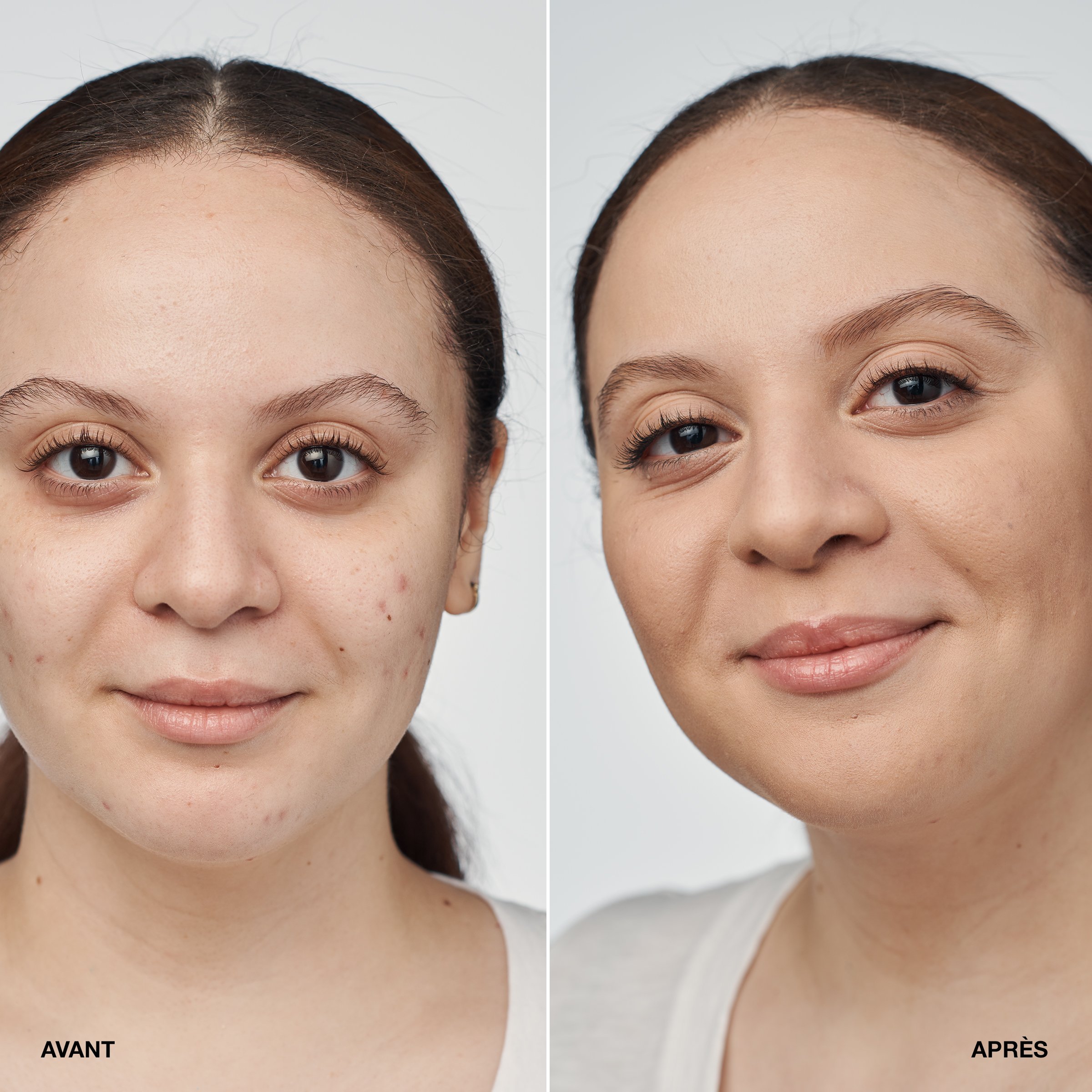 Even Better Clinical Serum Foundation SPF 20 | Wn 04 bone CLINIQUE Beauty