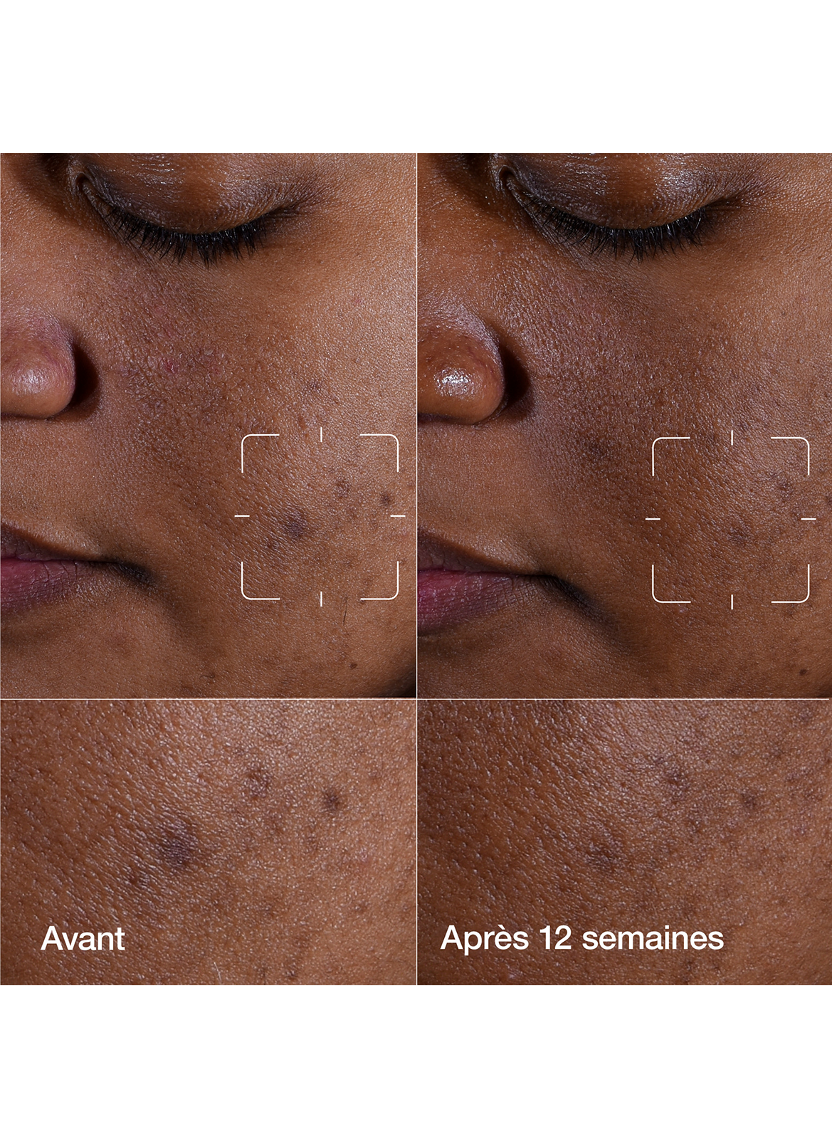 Even Better Clinical™ - Sérum Illuminateur Anti-taches CLINIQUE No color