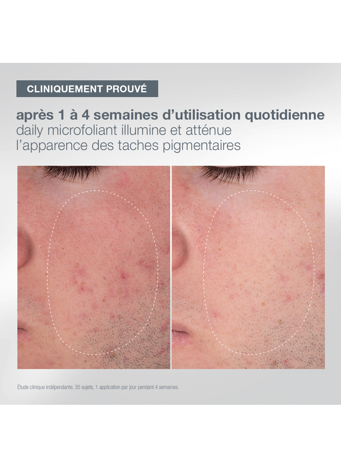 Coffret first snow of the season DERMALOGICA No color