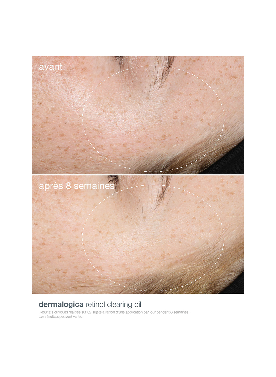 Retinol Clearing  Oil DERMALOGICA No color