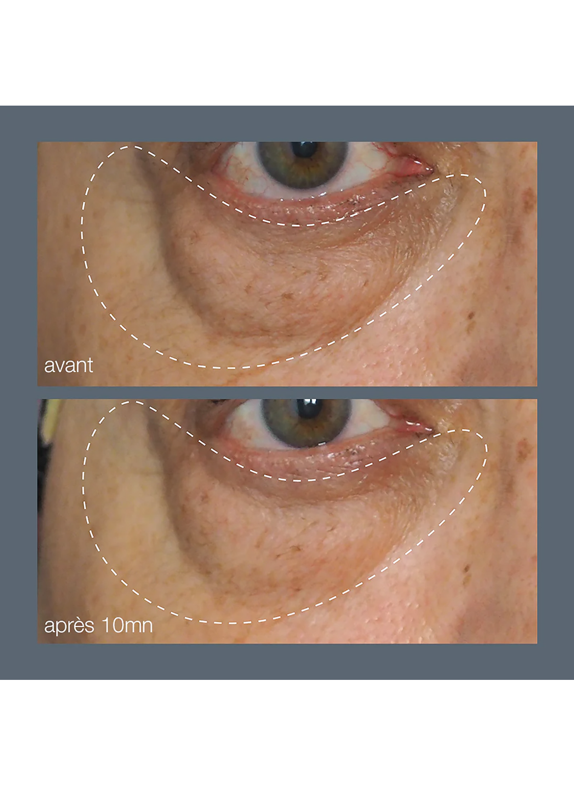 Awaken Peptide Eye Gel DERMALOGICA No color