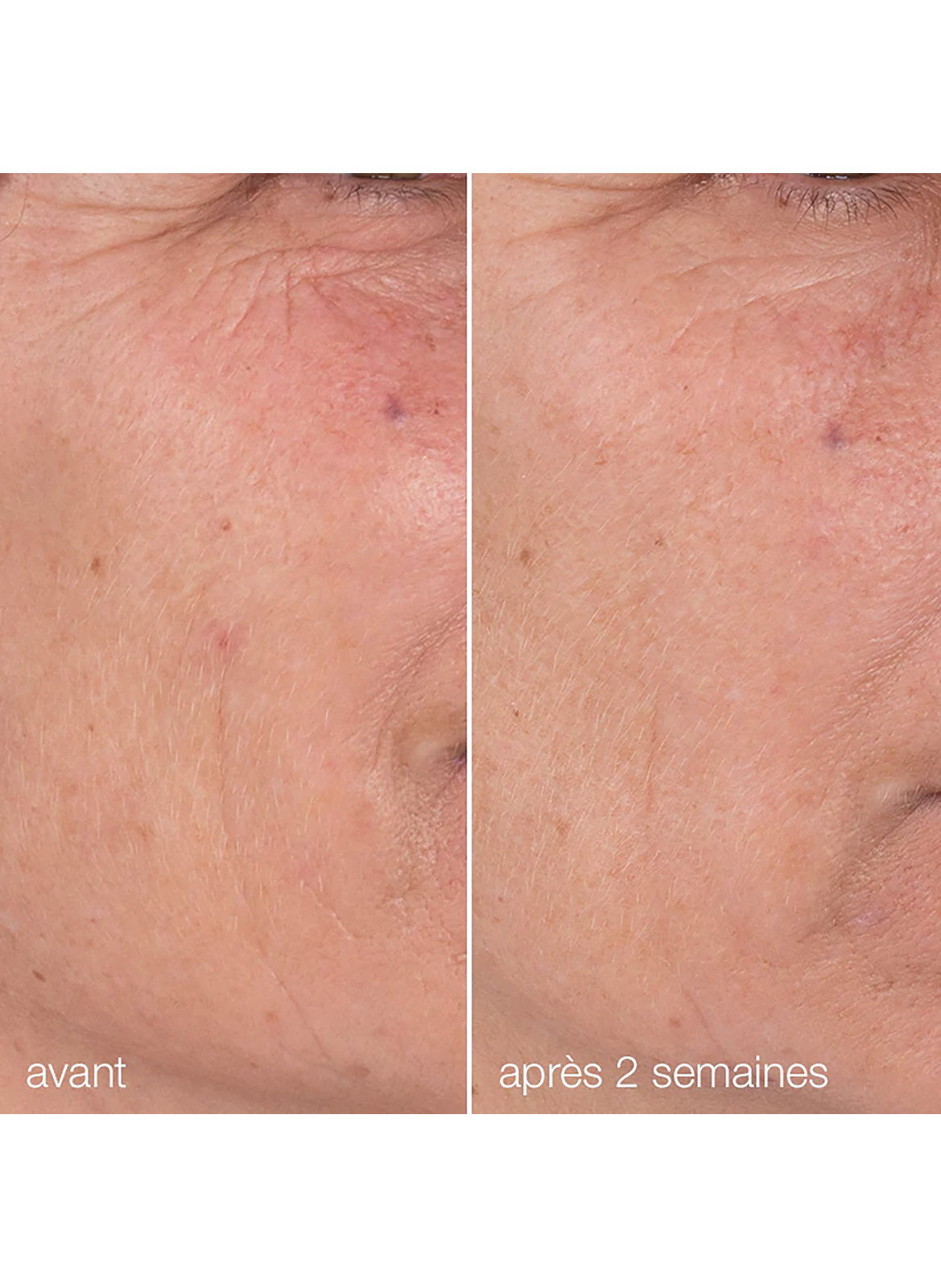 Dynamic Skin Retinol Serum DERMALOGICA No color