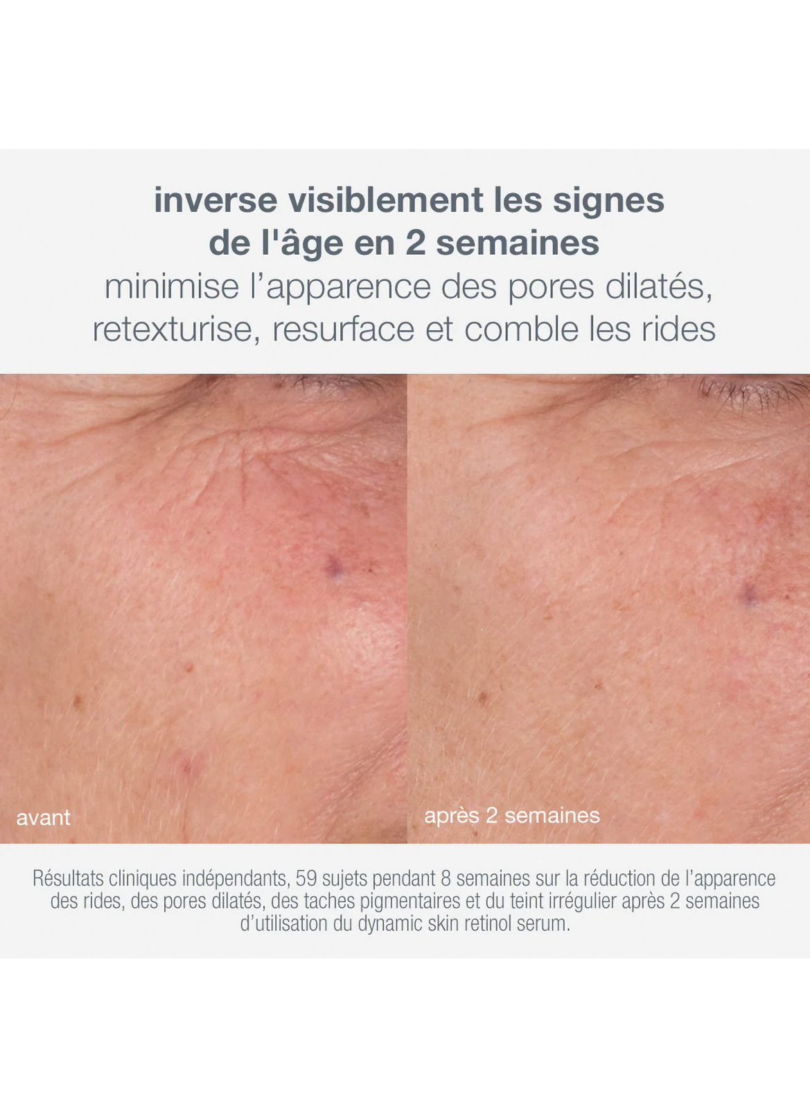 Skin aging solutions kit DERMALOGICA No color