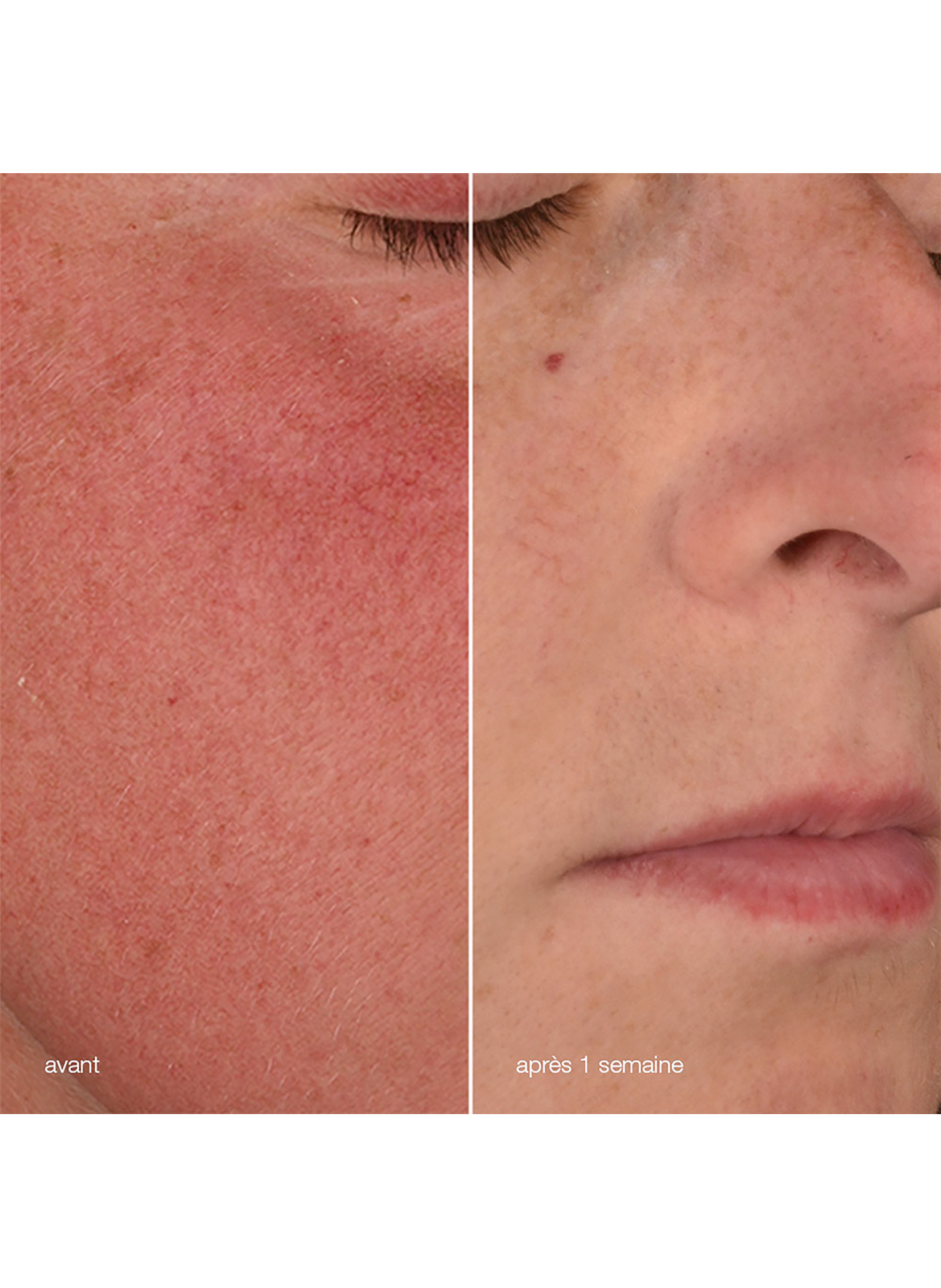 Stabilizing repair cream DERMALOGICA No color