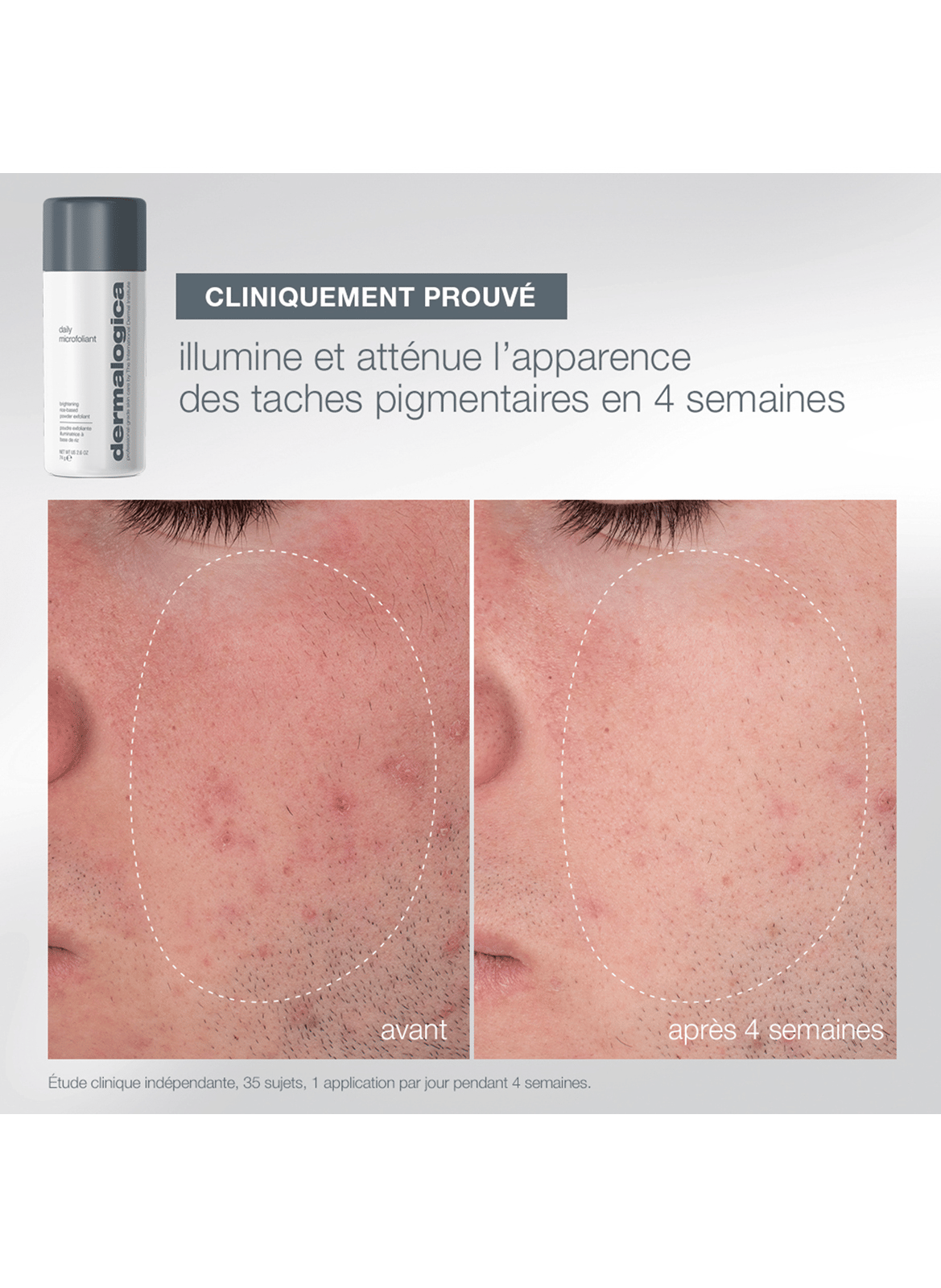 Expert Cleanse + Glow DERMALOGICA No color