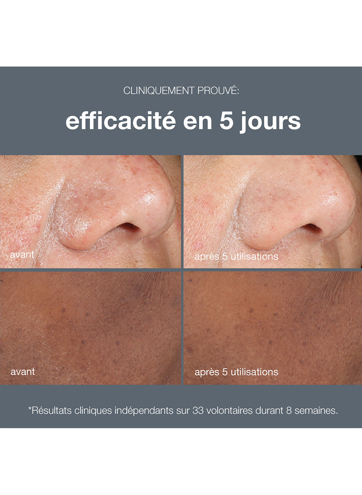 PowerBright Dark Spot Peel DERMALOGICA No color