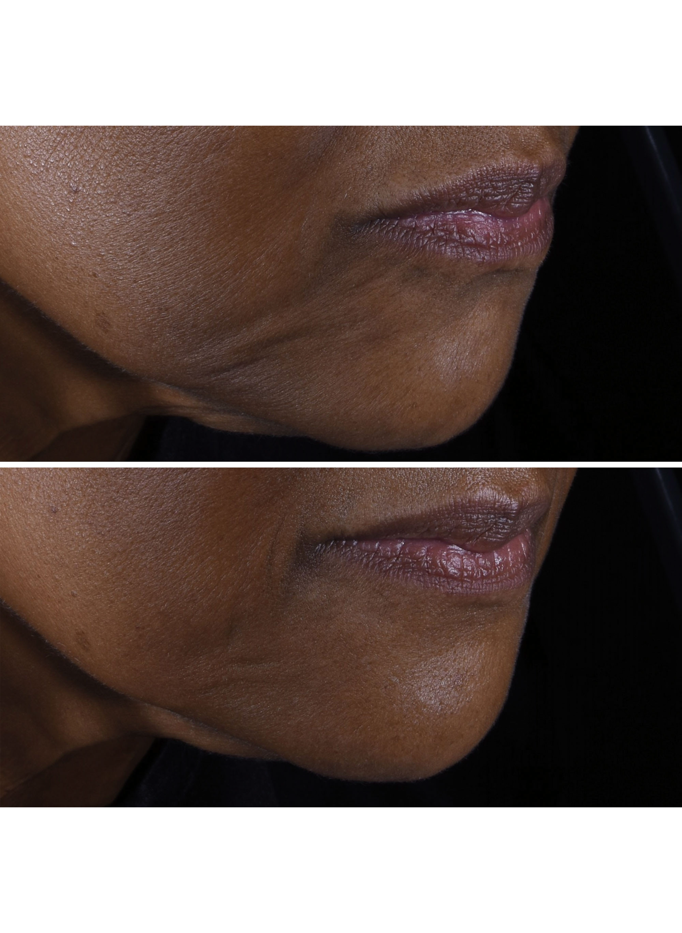 Smart Clinical Repair™ - Crème Liftante Visage + Cou CLINIQUE No color