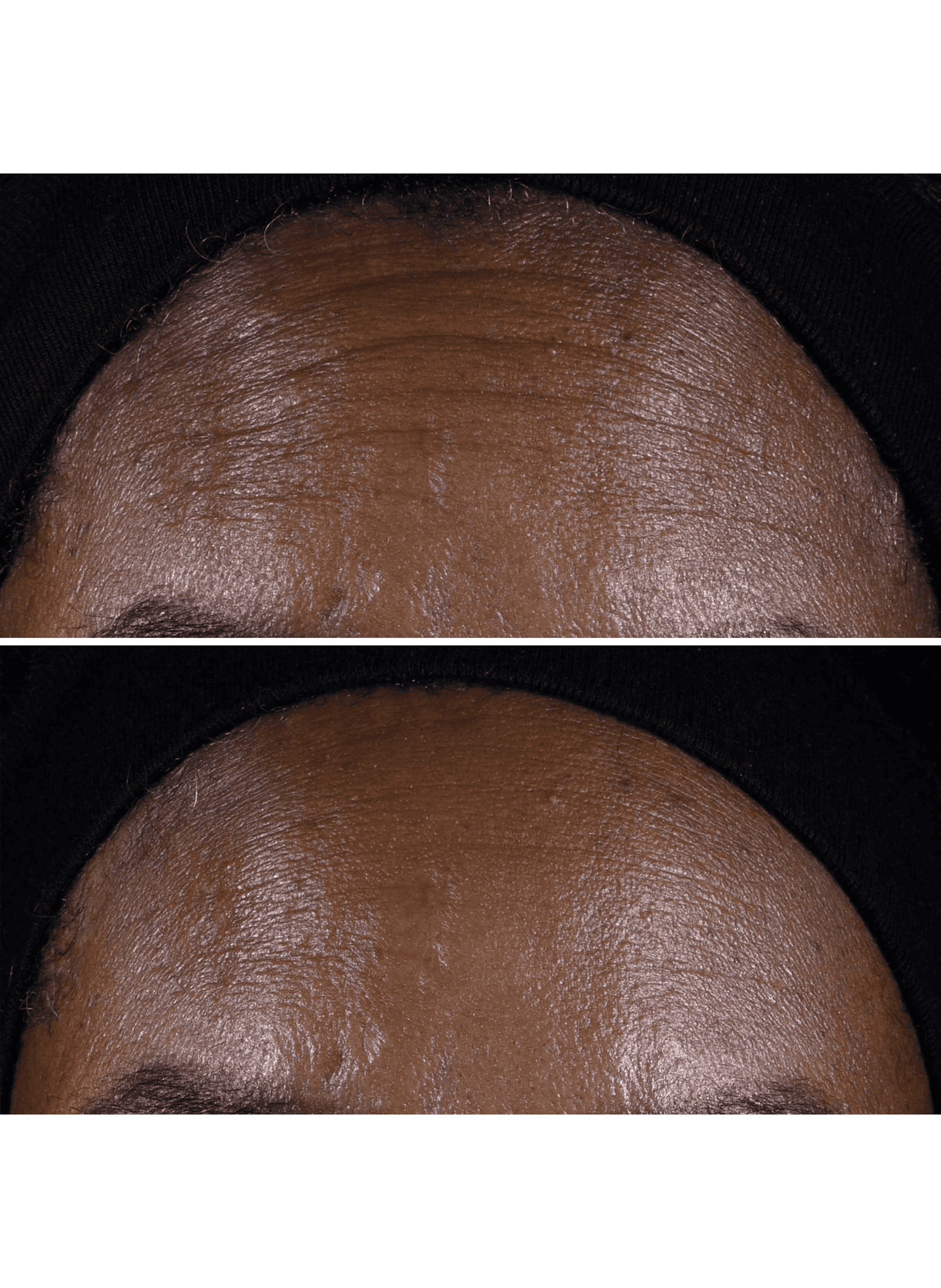 Smart Clinical Repair™ - Crème Liftante Visage + Cou CLINIQUE No color