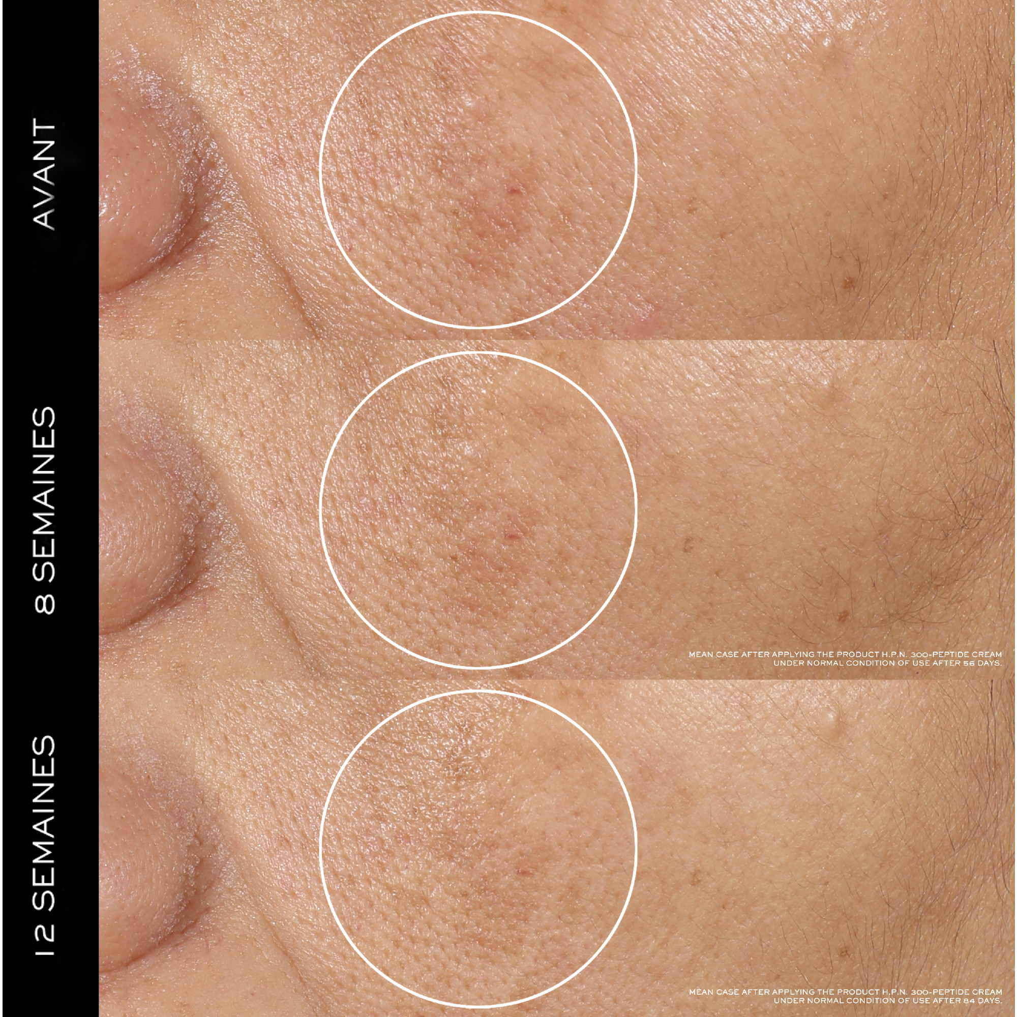 Rénergie H.P.N. 300-Peptide - Straffende Anti-Aging-Tagescreme LANCÔME No color