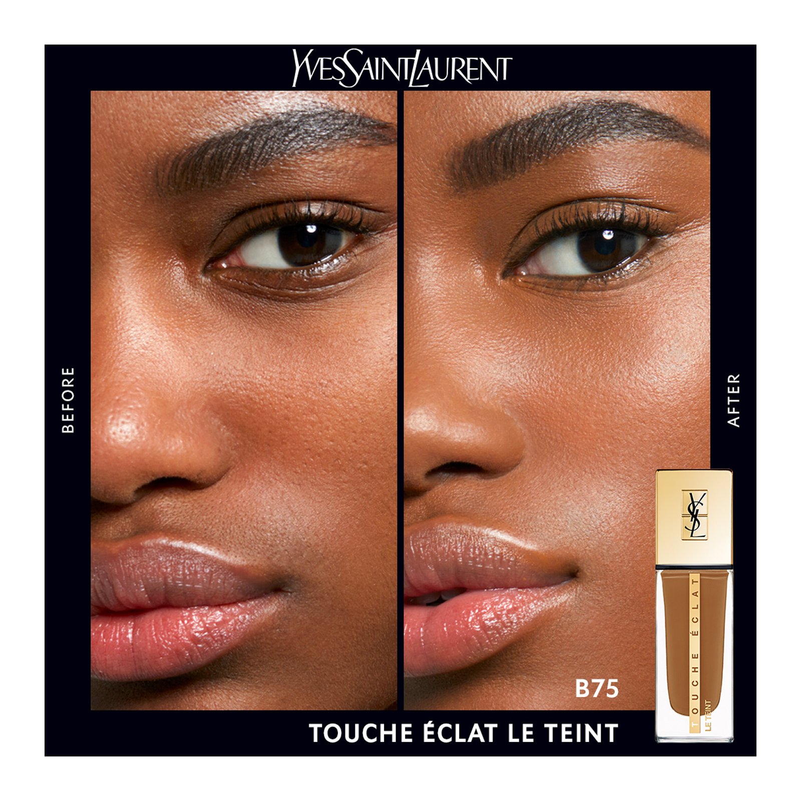 Touche Éclat Le Teint - Fond de Teint YVES SAINT LAURENT Beige 75