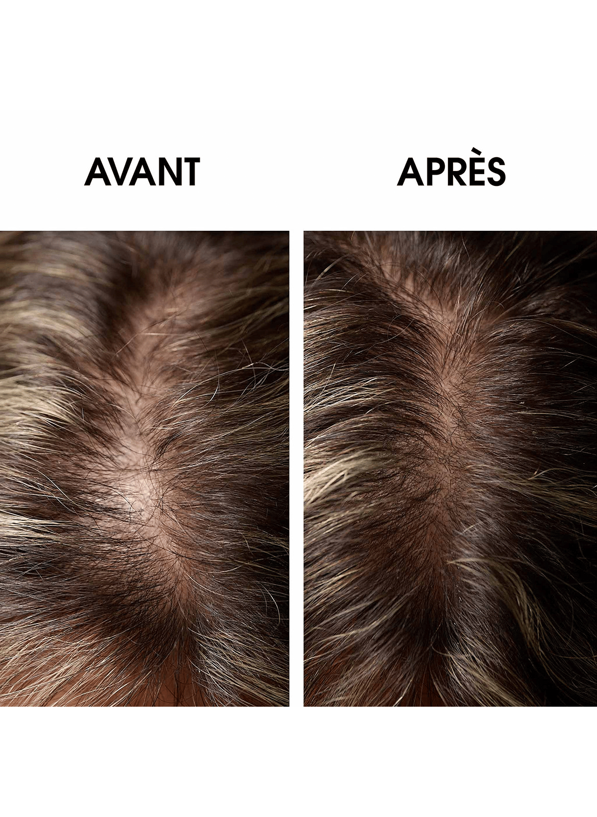 Régénérescence Naturelle LEONOR GREYL No color
