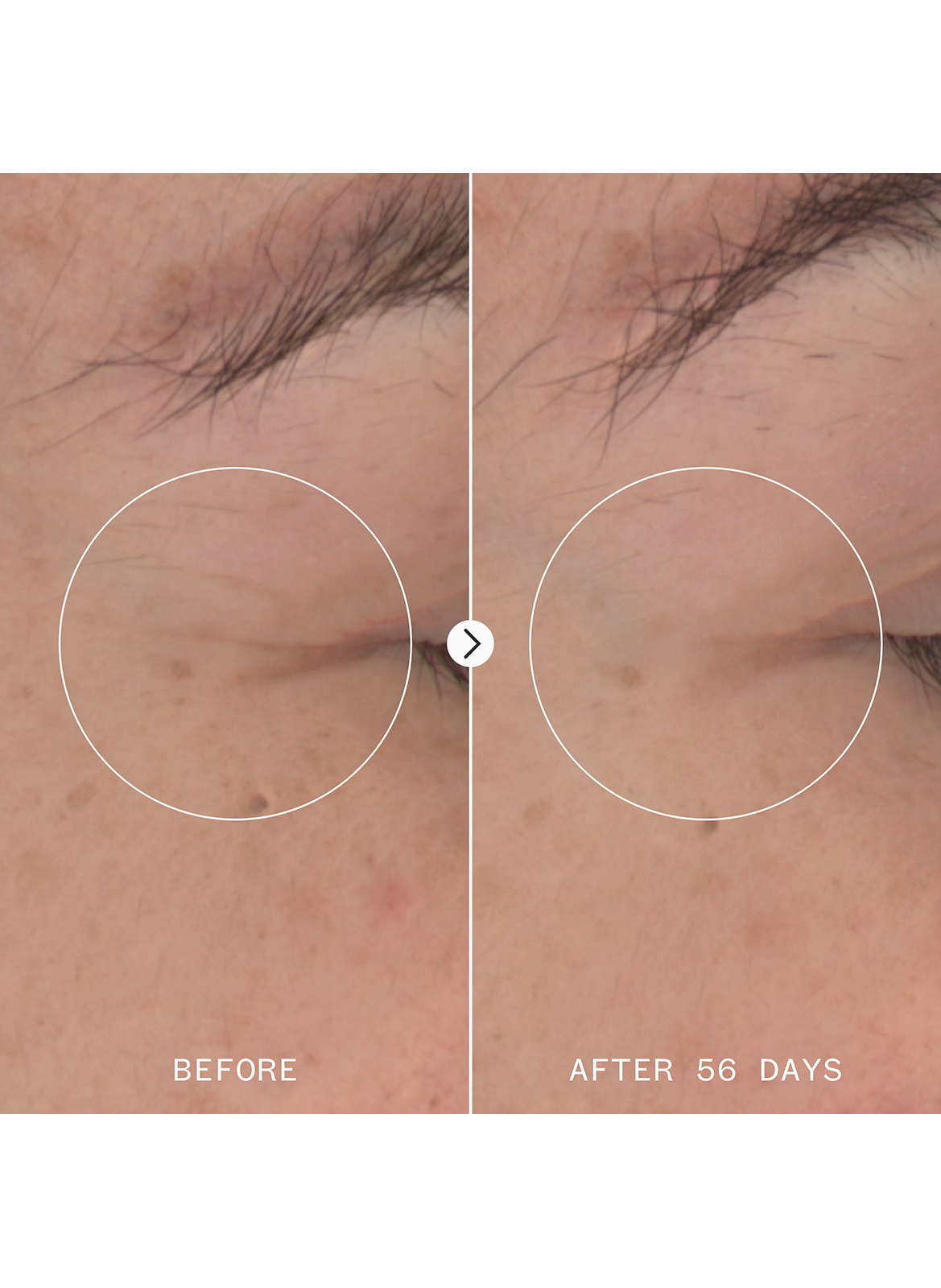 Age Confidence - Sérum Régénérant PAI SKINCARE No color