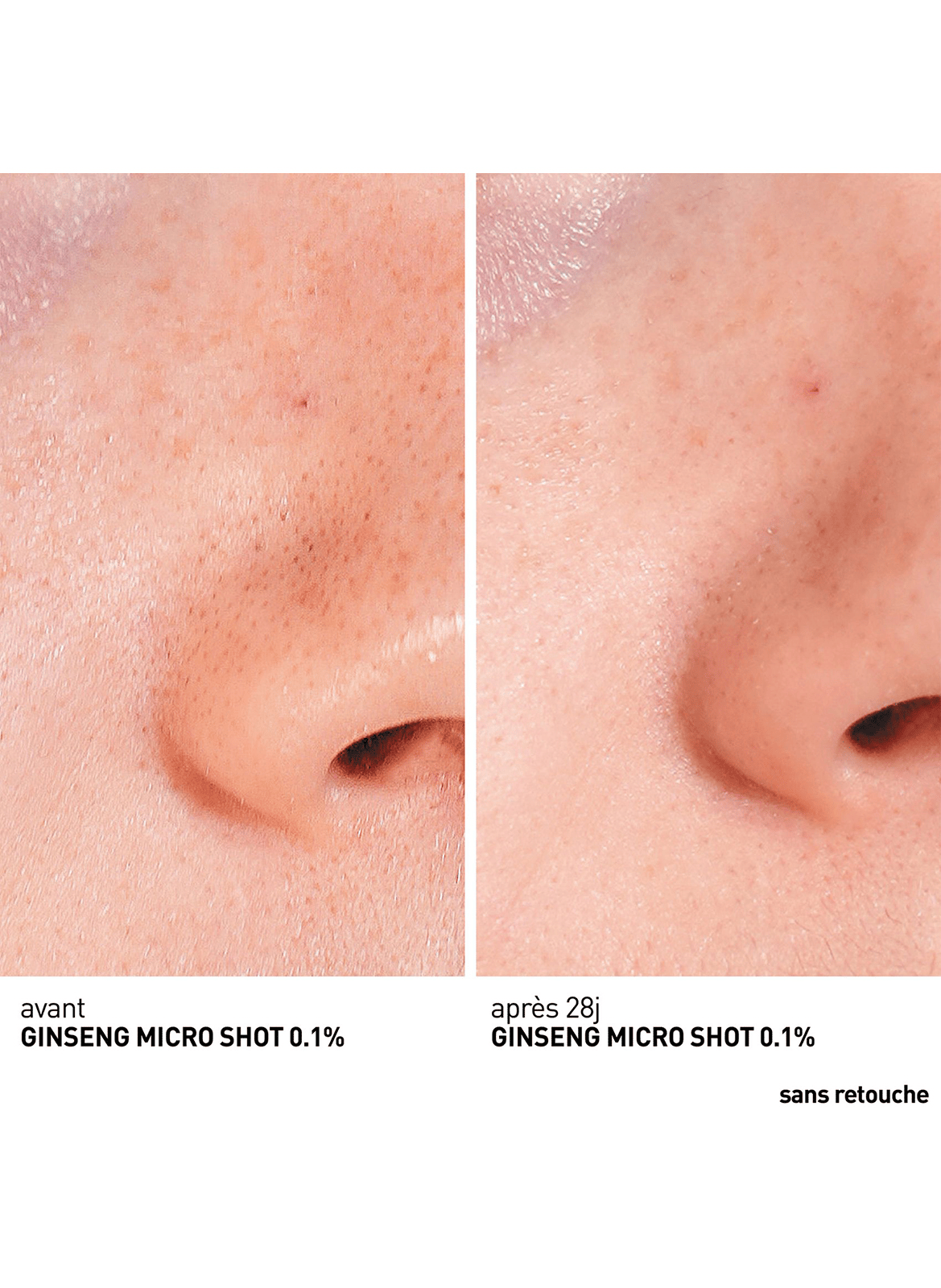 Ginseng Micro Shot Starter 0.1 - Sérum micro-infusion retexturant (concentration en spicules 0.1%) ERBORIAN No color