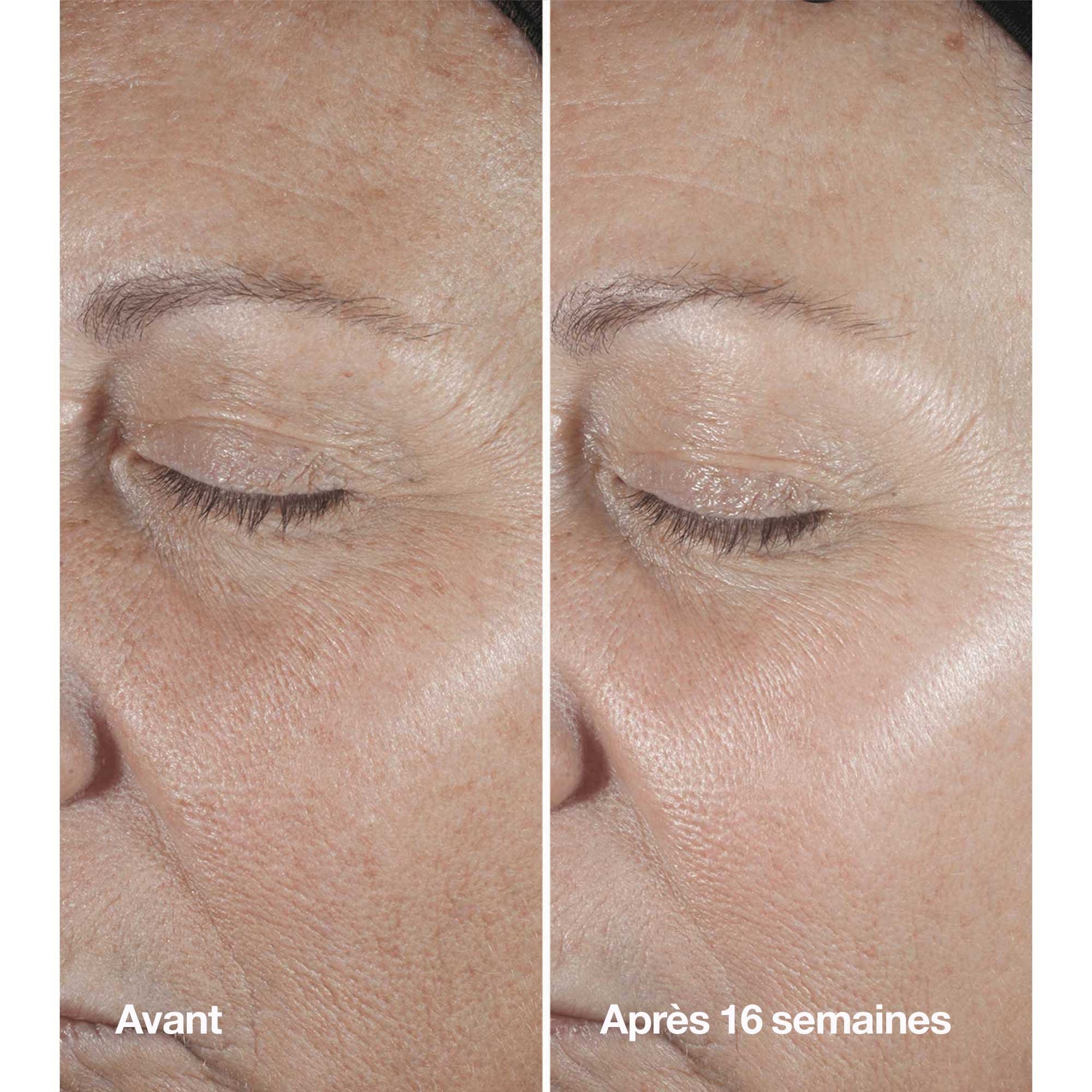 Clinique Smart Clinical Serum - Anti-wrinkle Corrective Serum CLINIQUE No color