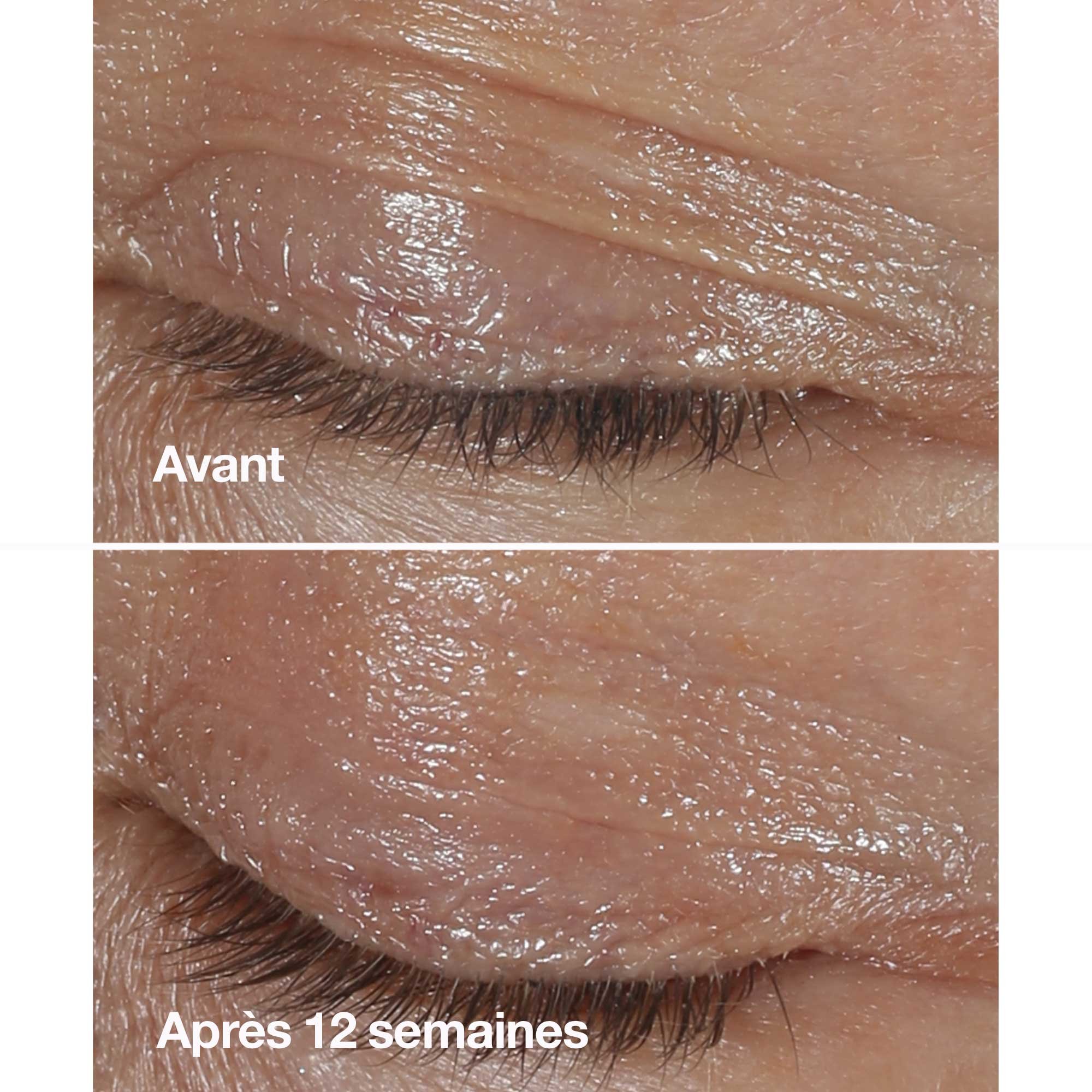 Smart Clinical Repair - Wrinkle Correcting Eye Cream CLINIQUE No color