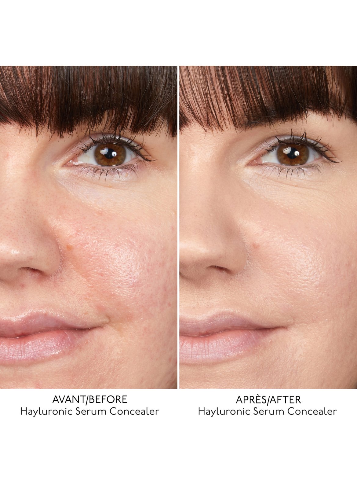 HYALURONIC SERUM CONCEALER 5. Creme Beige 6. peach beige