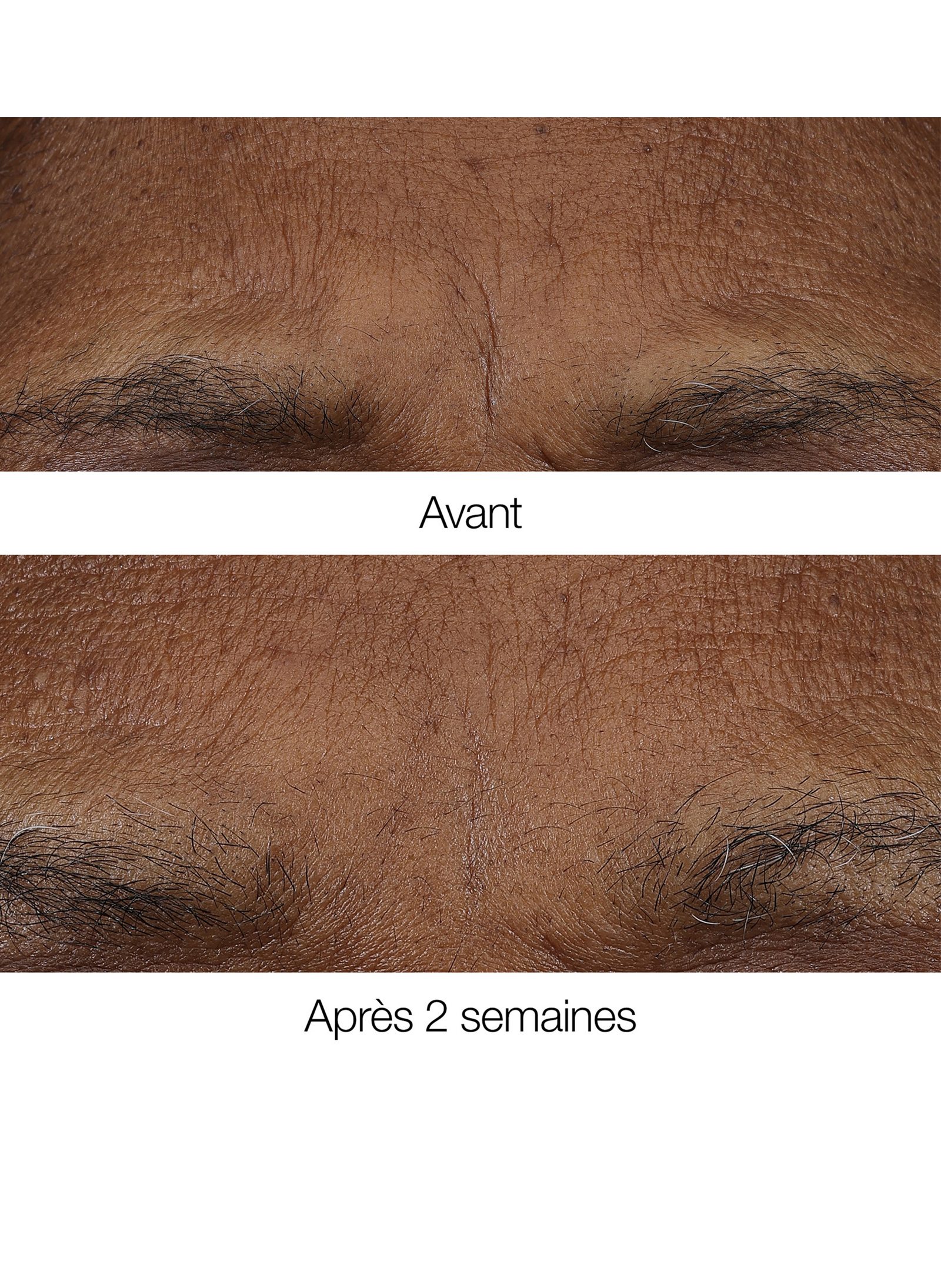 Smart Clinical Repair™ - Baume Rétinoïde Anti-rides matin et soir CLINIQUE No color