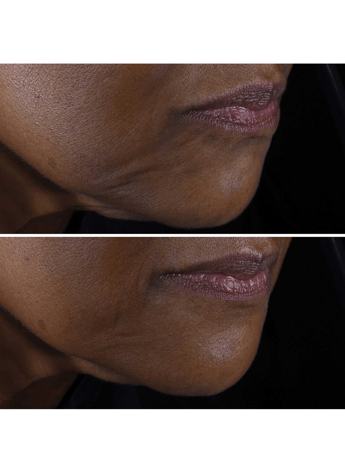 Smart Clinical Repair™ - Anti-aging & Firming Hydration Set CLINIQUE No color