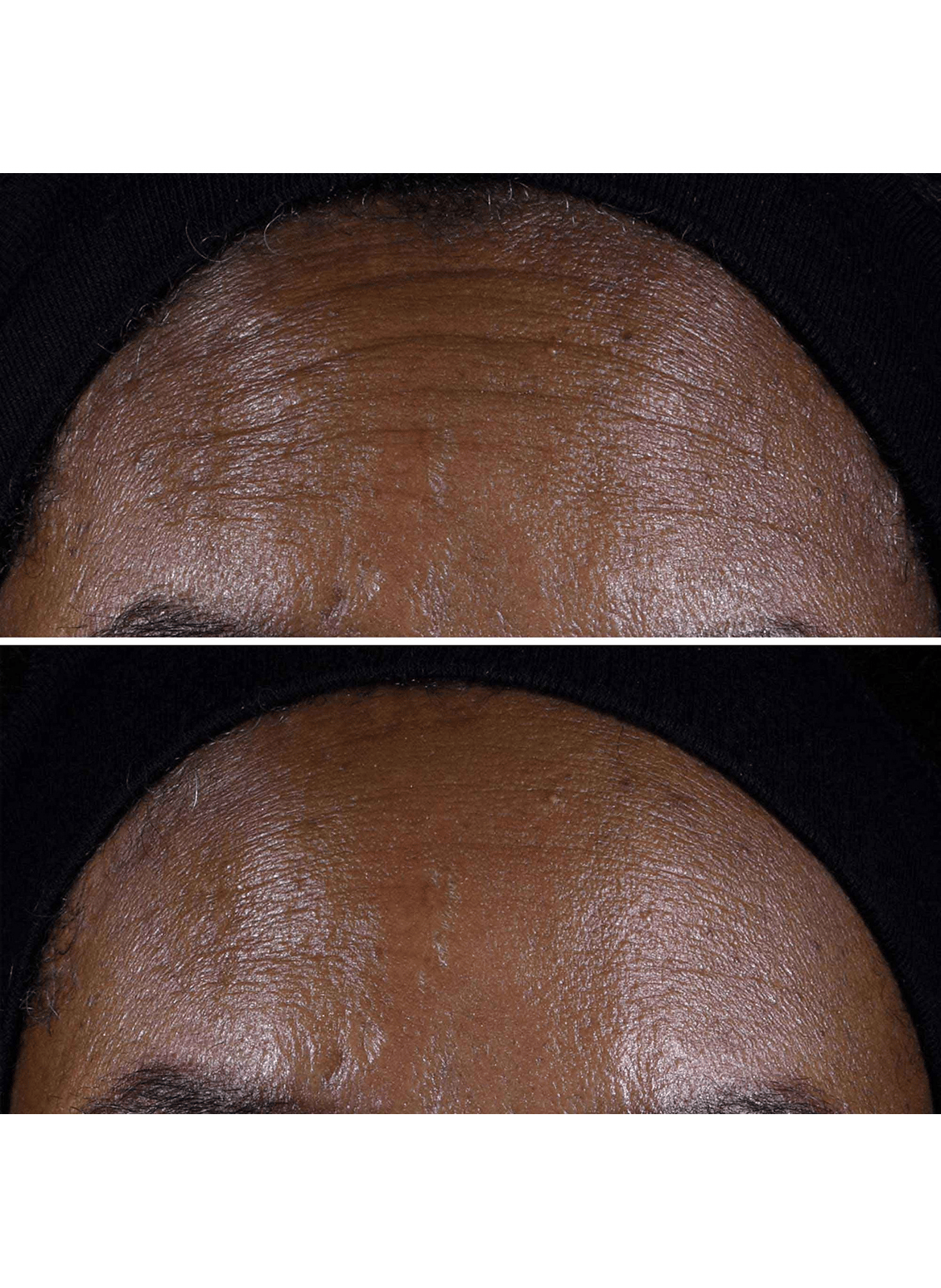 Smart Clinical Repair™ - Anti-aging & Firming Hydration Set CLINIQUE No color