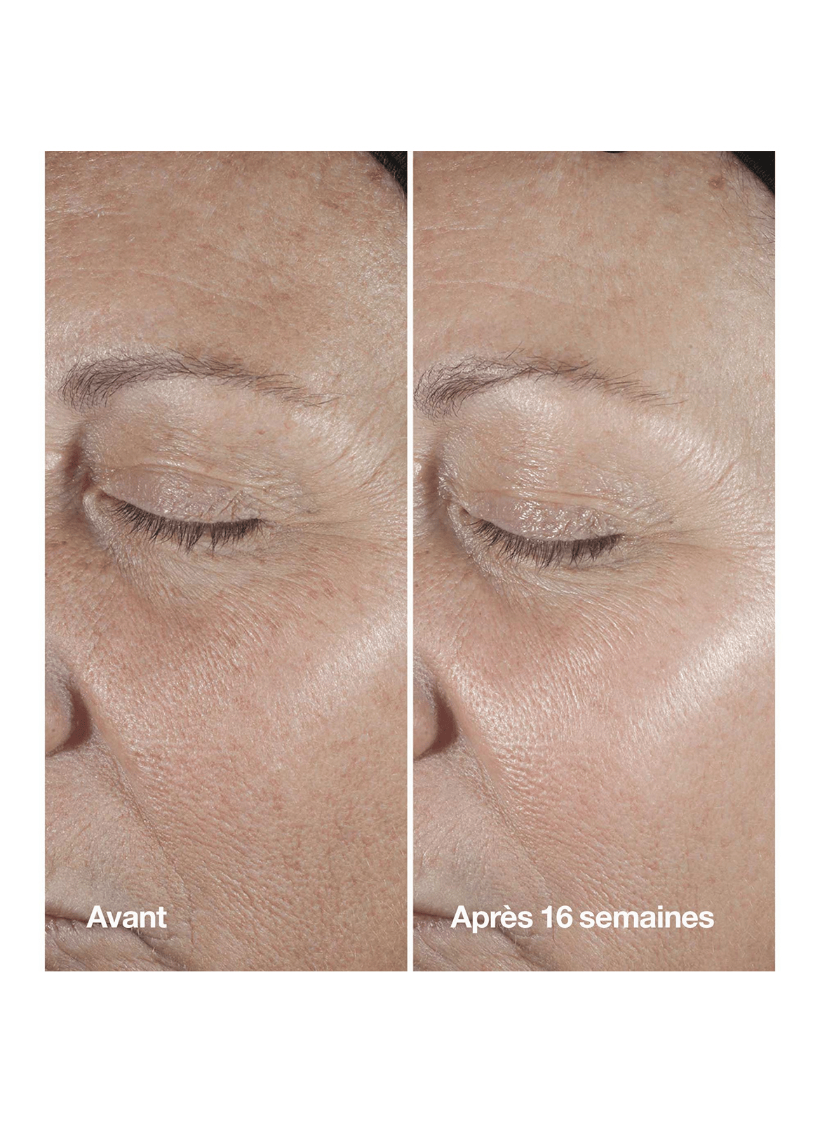 Smart Clinical Repair™ - Anti-aging & Firming Hydration Set CLINIQUE No color