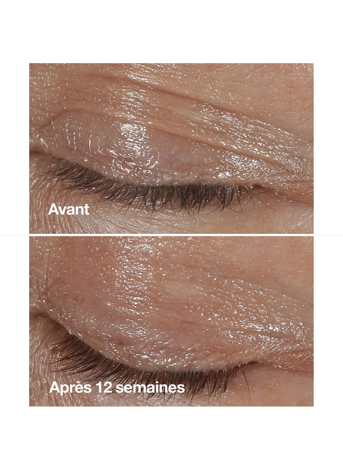 Smart Clinical Repair™ - Anti-aging & Firming Hydration Set CLINIQUE No color