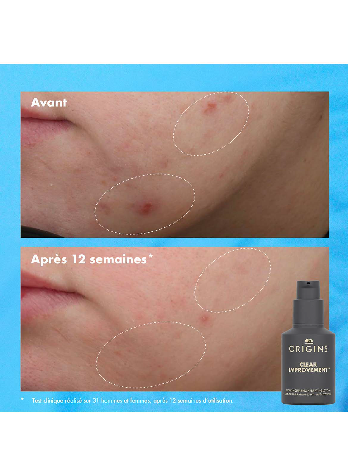 Clear Improvement™ - Lotion Hydratante Anti-imperfections ORIGINS No color