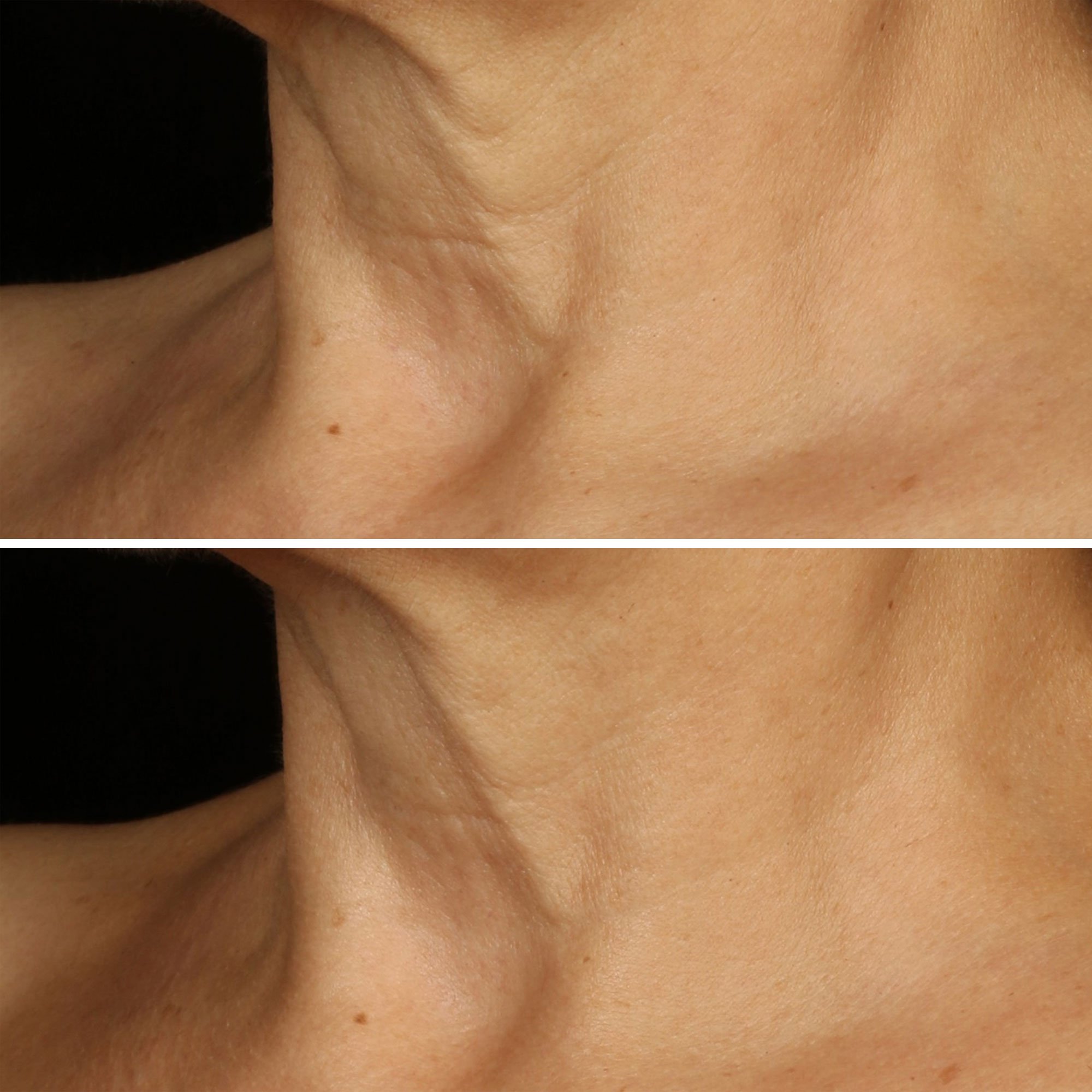 Smart Clinical Repair(TM) Crème Liftante Visage + Cou CLINIQUE No color